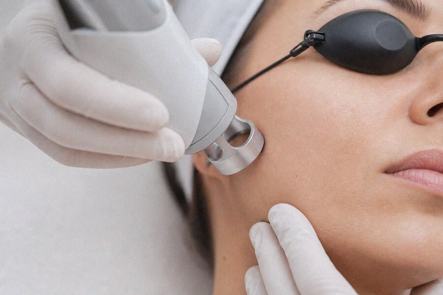 Laser Treatments photo